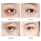 Collagen Gel Dark Circles Remover Eye Patches